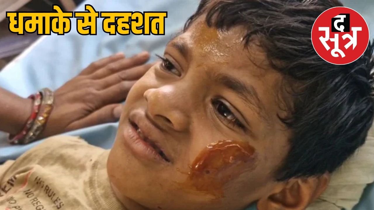 बैतूल जिले में खेल-खेल में डायनामाइट फटने से 4 बच्चे गंभीर रूप से घायल