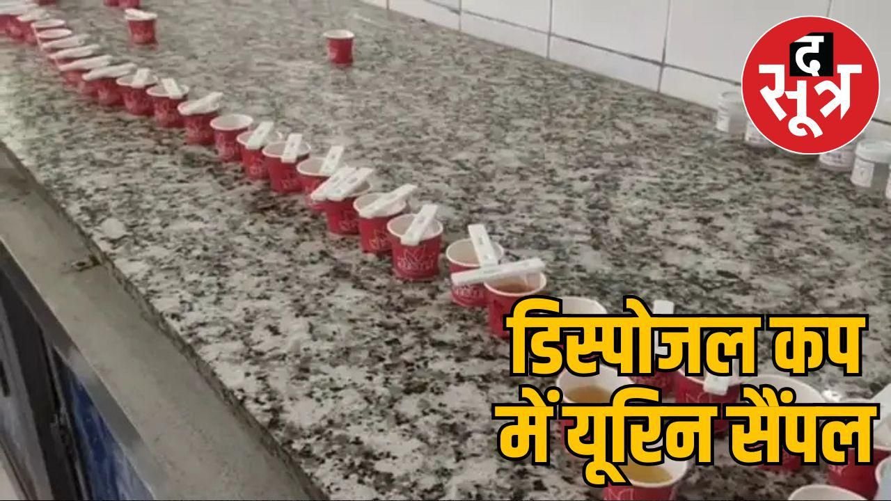 अजब एमपी में गजब का मामला: अस्पताल में यूरिन सैंपल के लिए चाय के डिस्पोजल कप का इस्तेमाल